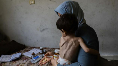 خلال يوم واحد.. وفاة 8 أشخاص بينهم طفل نتيجة المجاعة في القطاع