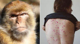 أستاذ في علم الفيروسات يوصي بالتوقي من عدوى جدري القردة وتكثيف عمليات المراقبة
