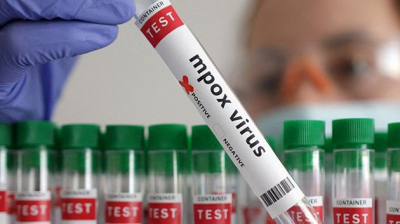 أوغندا ترصد إصابتيْن جديدتيْن بجدري القردة